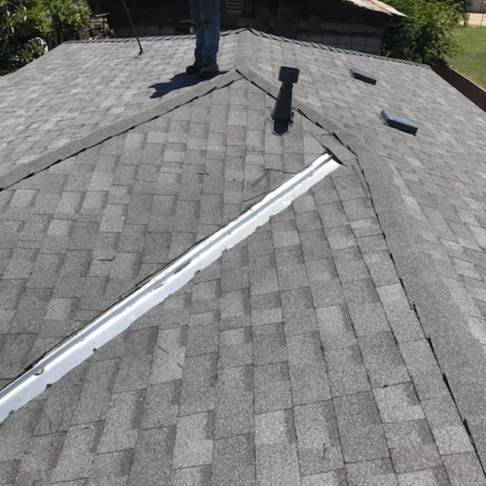 Shingles
