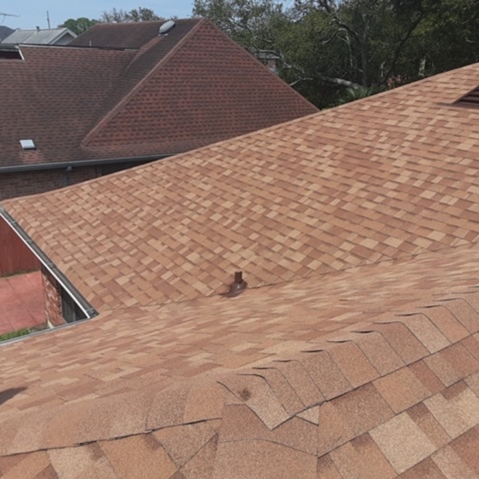 Shingles